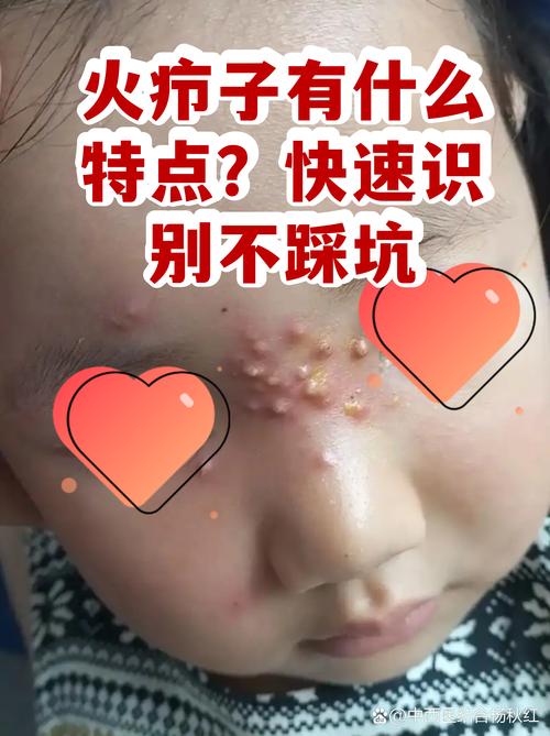 火起来之后的坑，别踩