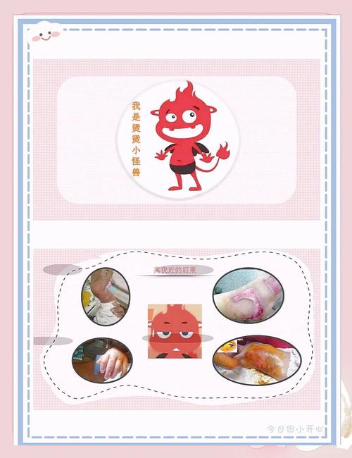 怪味、烫伤、起火？安全是底线