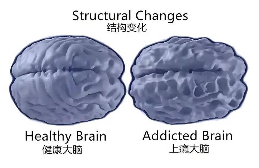 大脑多巴胺分泌与短视频奖励机制示意图