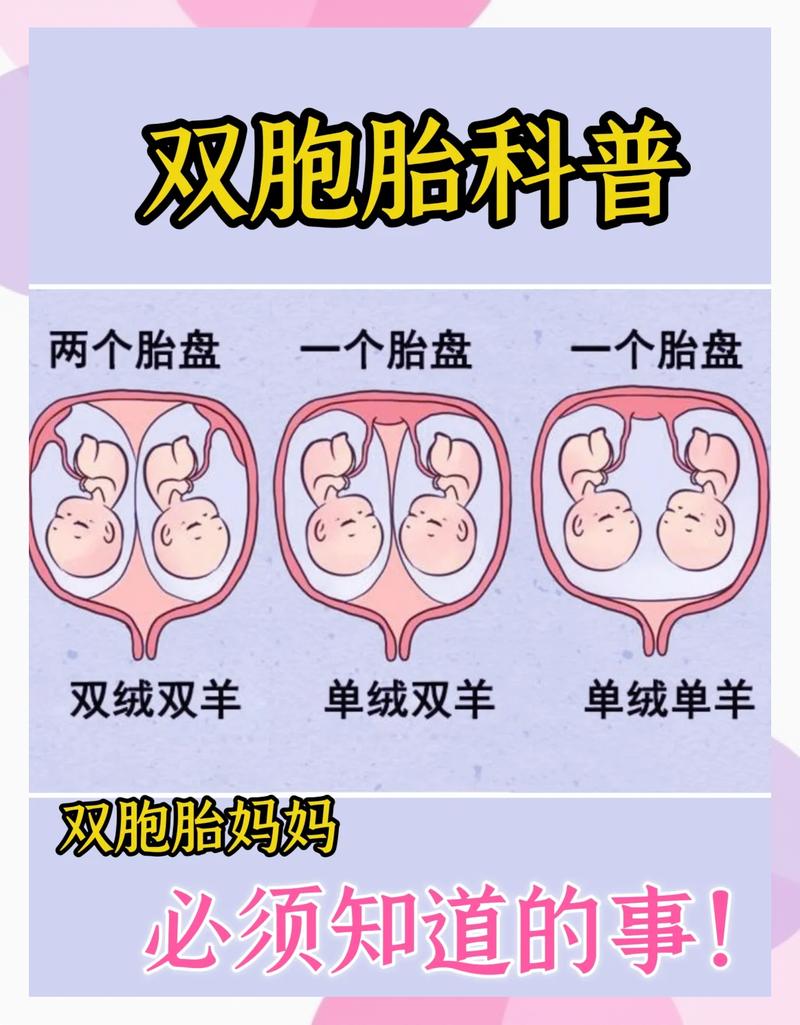 易混淆知识点：这些“双胞胎”概念，你分清了吗？