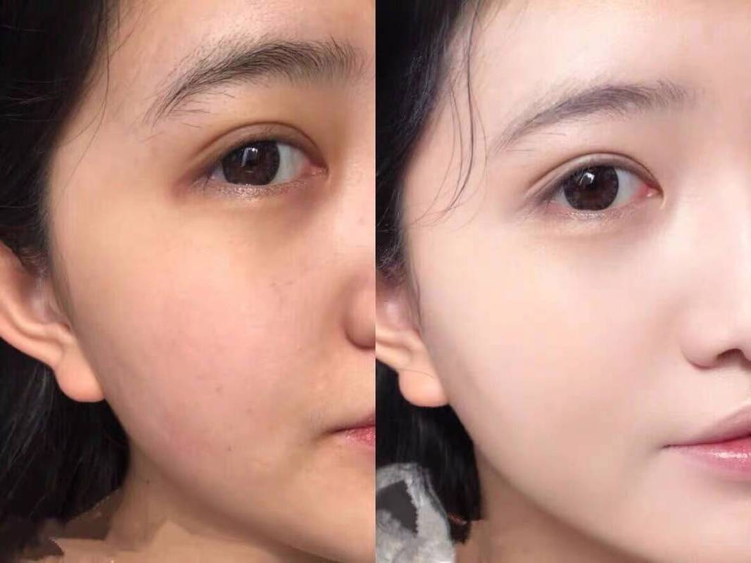 晨间护肤洁面适用肤质对比图