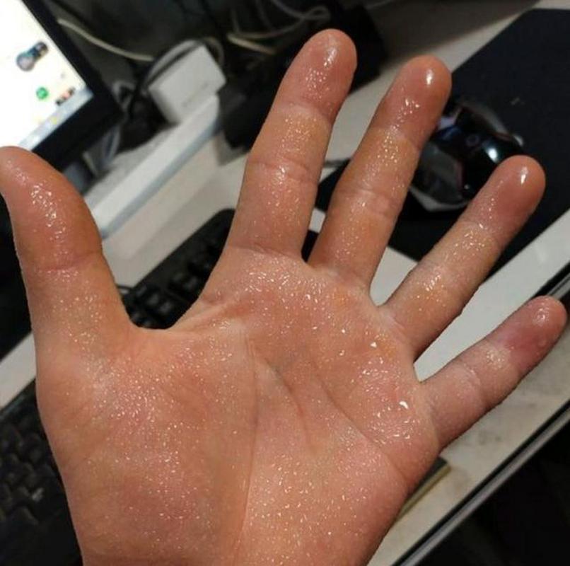 考试紧张手心出汗学生特写