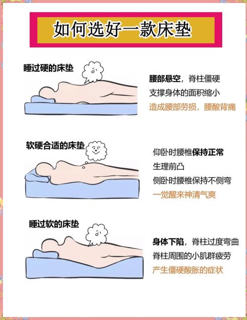 腰椎间盘突出者试床垫硬度手法图