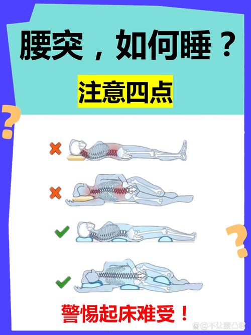 腰椎间盘突出患者睡硬板床腰部悬空示意图