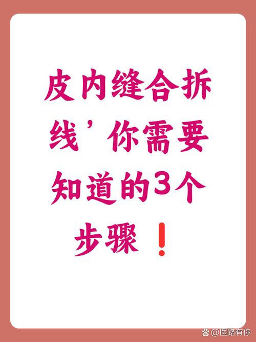 真要动手整理，别上来就拆线