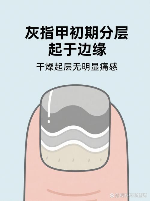 分层也有不能越的边界