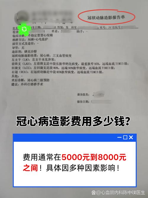 那到底值不值得为血压监测买单?