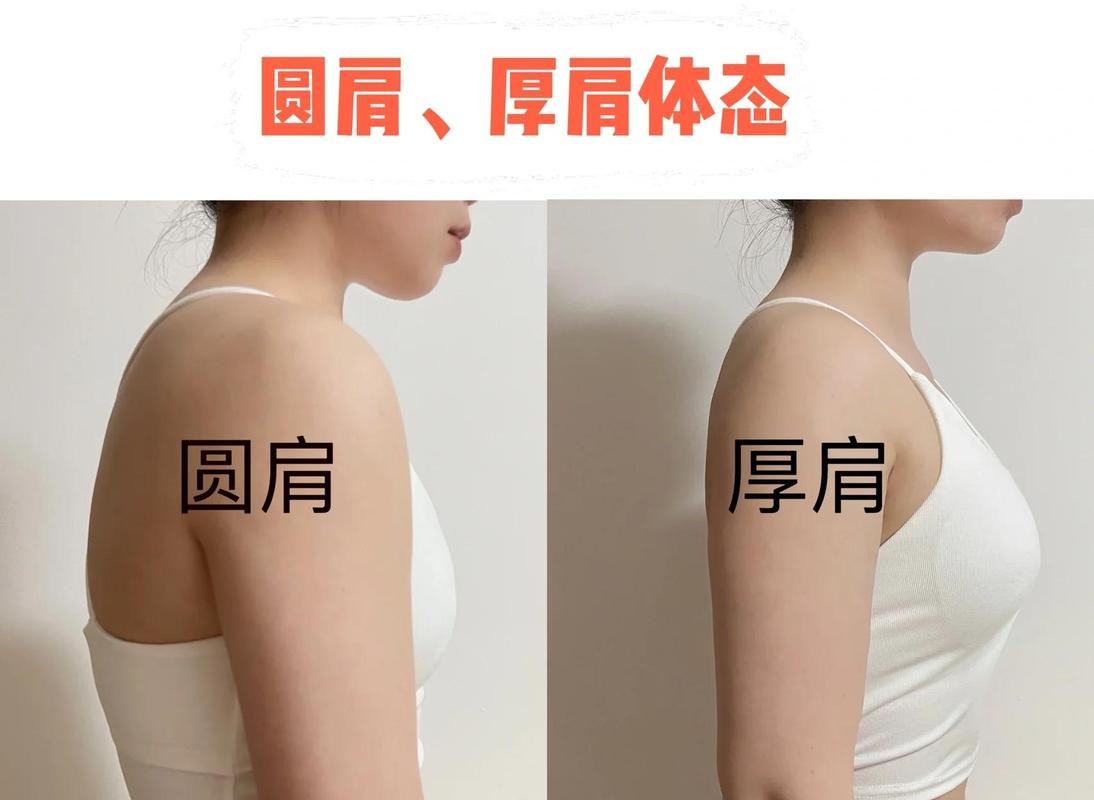 办公室上班族轻微圆肩体态对比图