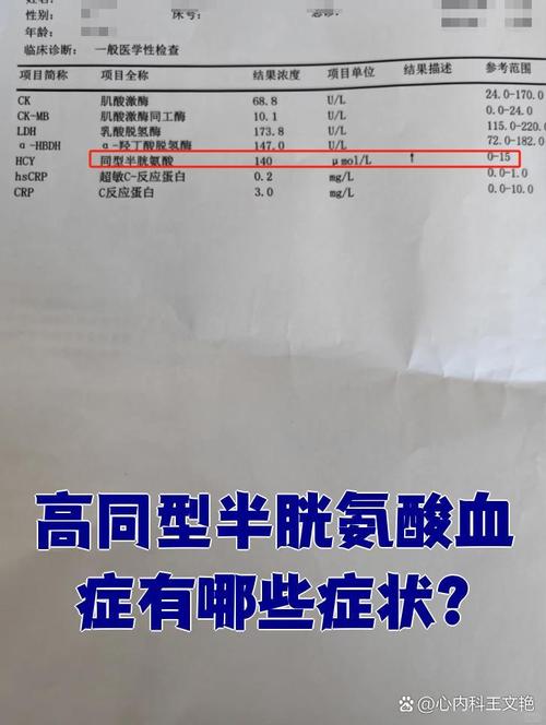 高同型半胱氨酸血症体检报告异常箭头