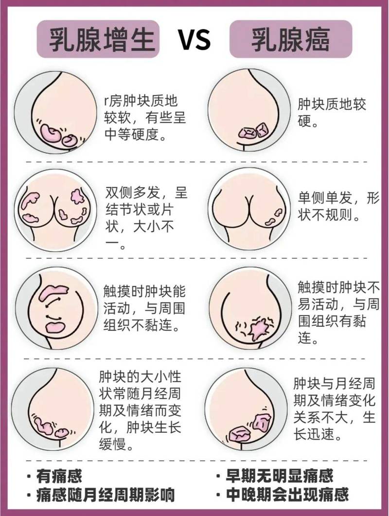 哺乳期乳房早期硬块位置对照示意图