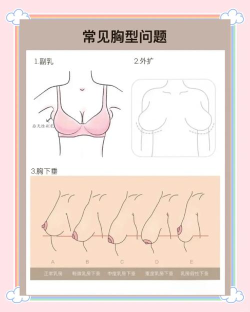 你忽略了最重要的一件——内衣