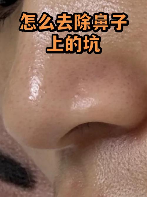 四、那些你可能想不到的坑