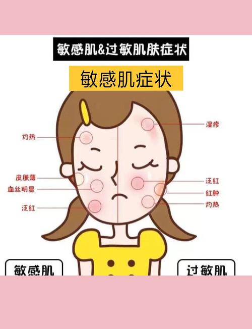 皮肤敏感的朋友,得避开这几个坑