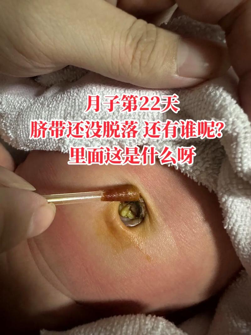 问:那脐带还没掉,能拍吗?会不会感染?