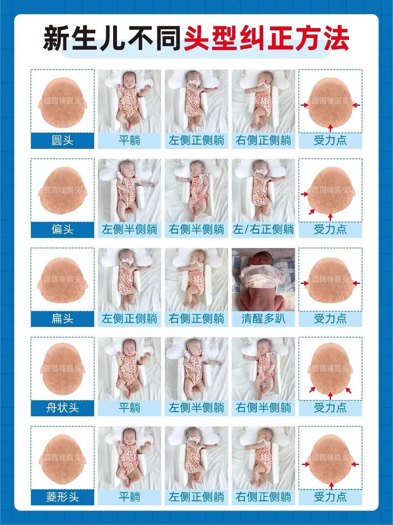 婴儿睡平头与正常圆头头型对比图