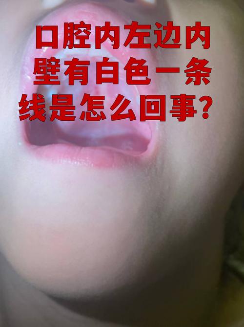 宝宝口腔清洁的就医红线