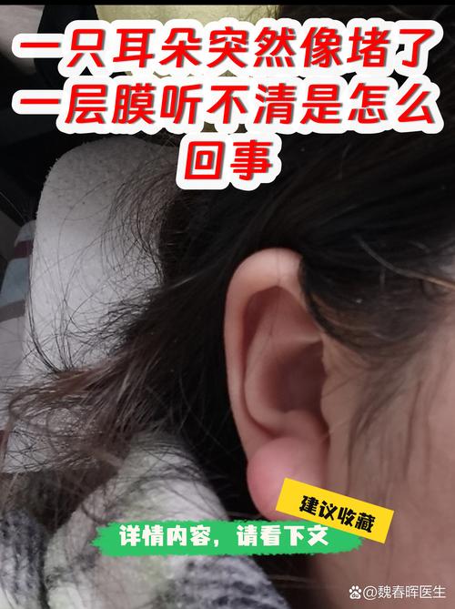 为什么你的膜总堵?