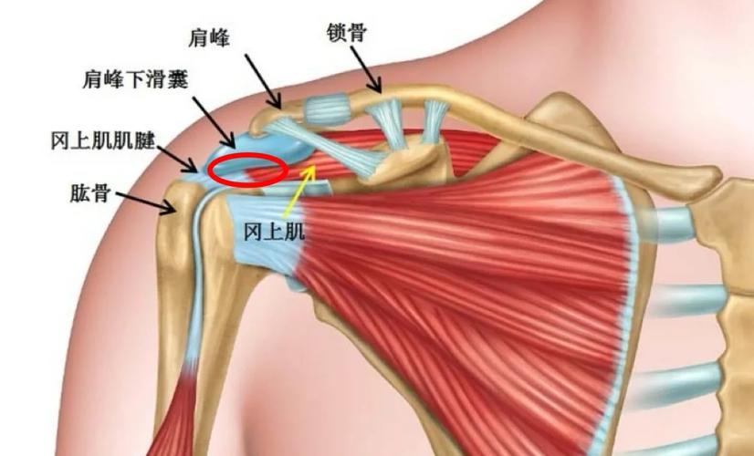 肩峰撞击肩部动作受力示意图