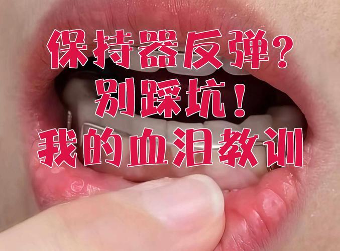 新手入门别踩这些坑！我的血泪教训