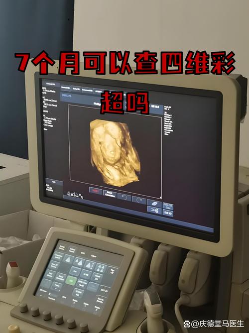 孕妇做四维彩超检查胎儿面部