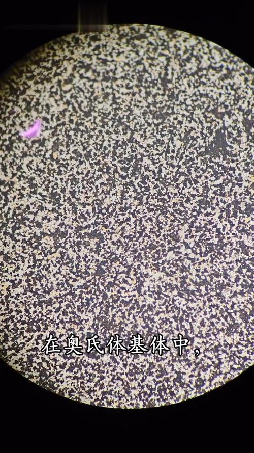 高速钢碳化物带状偏析金相