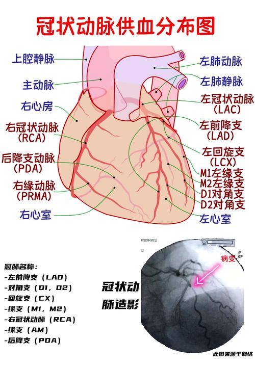 冷空气刺激冠状动脉收缩示意图