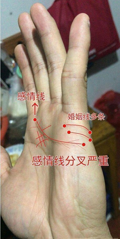 真遇上了,按这个步骤来不会错