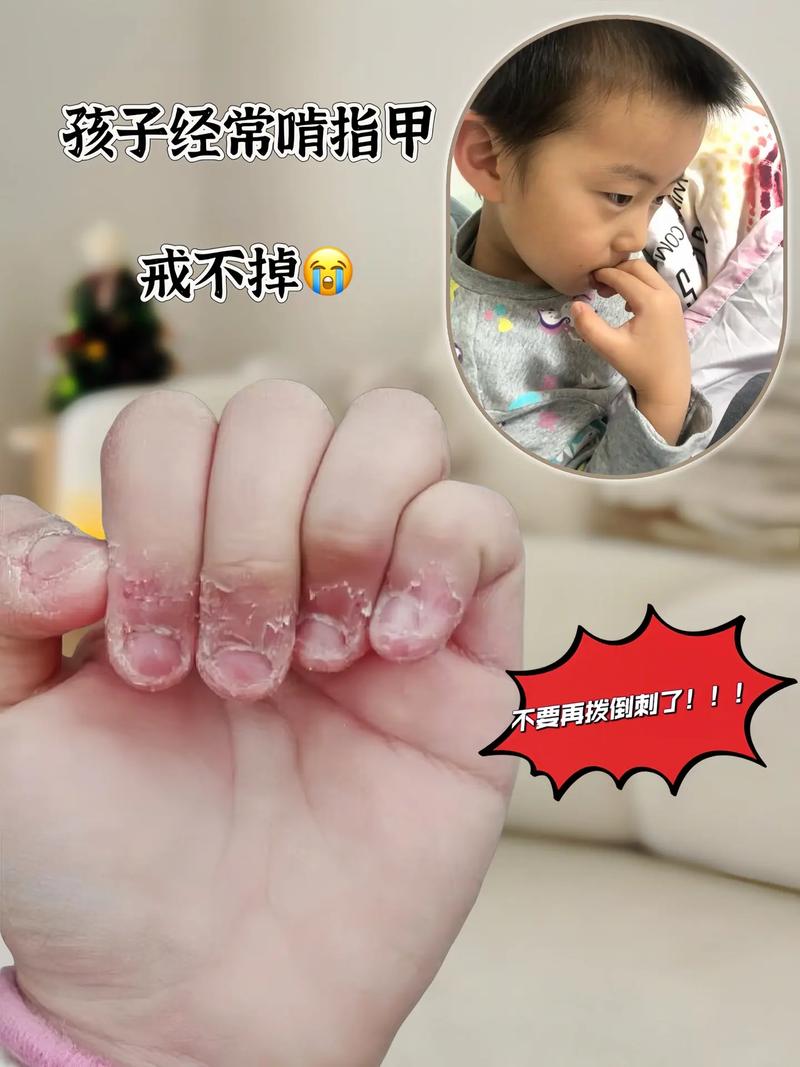 六岁焦虑：你家娃也有这些“怪毛病”吗？-超级宝贝