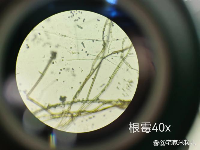 冰箱门封条霉菌特写显微镜图