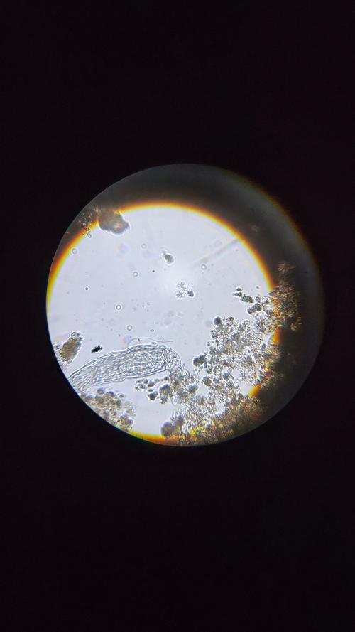 厌氧氨氧化菌颗粒污泥显微镜图