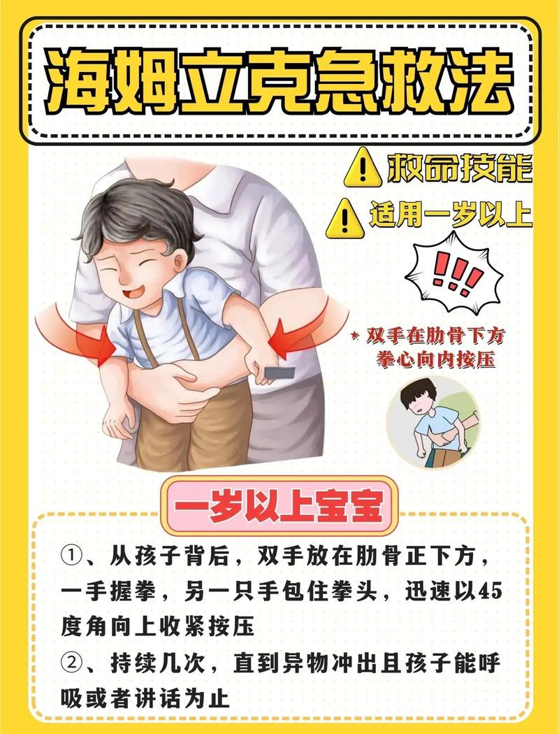 婴幼儿海姆立克急救操作演示图