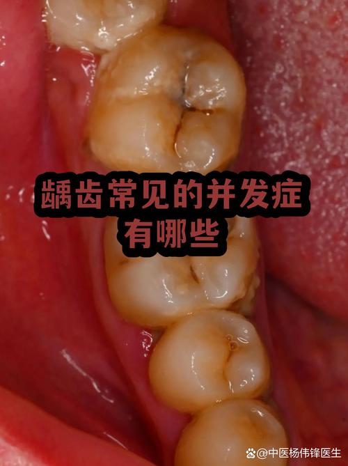 多0.1mm带来的连锁反应