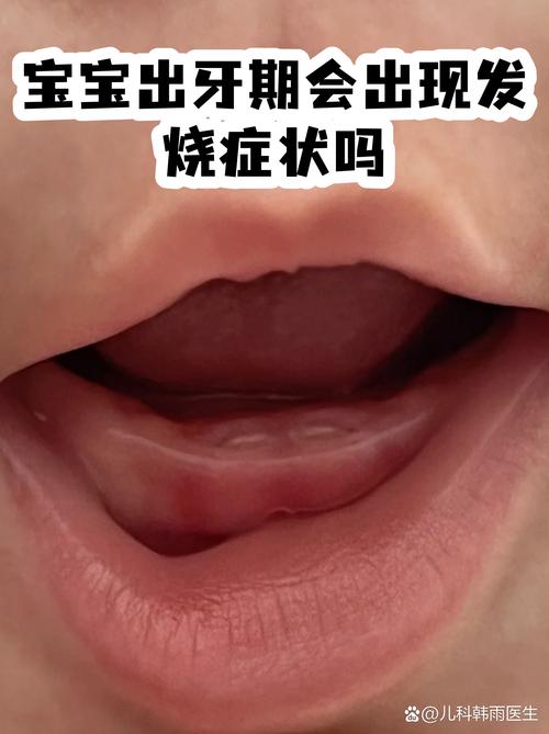 拱破包装纸的宝宝出牙不适