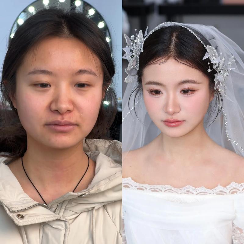 新娘牙齿美白，我踩过的坑你别再踩！婚前必看-婚庆网