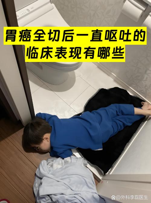 最后再吐个槽