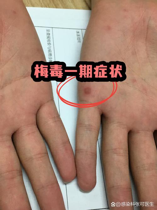 最容易被忽略的传染死角，我帮你列全了