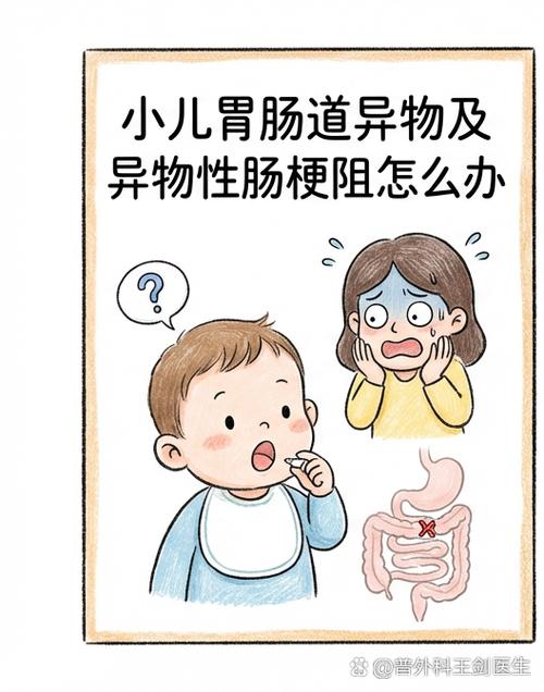 宝宝误吞后两块磁铁夹着肠壁的医学示意图