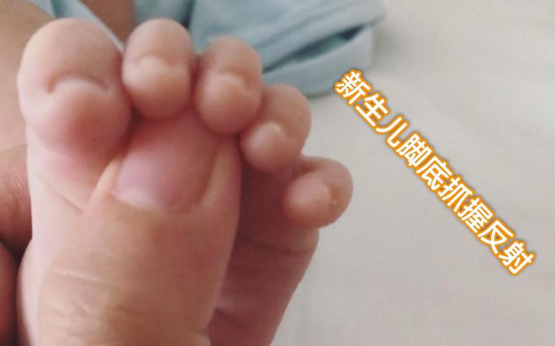 新生儿原始反射握持反应实拍