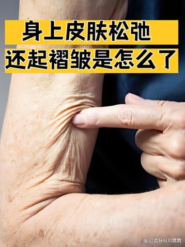 化纤面料引起皮肤不适的示意图