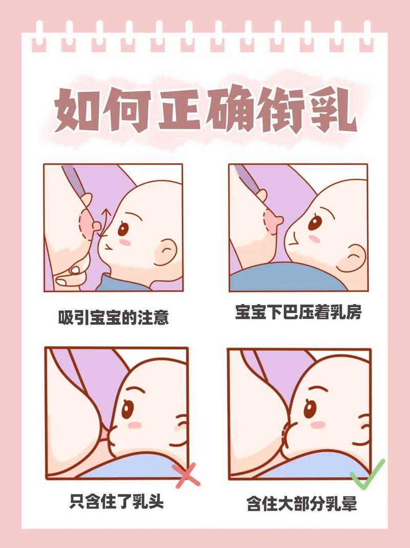 新生儿正确衔乳姿势示意图 含乳晕较深