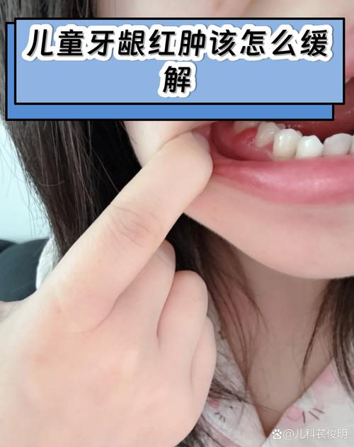 宝宝口腔敏感期牙龈红肿护理示意图