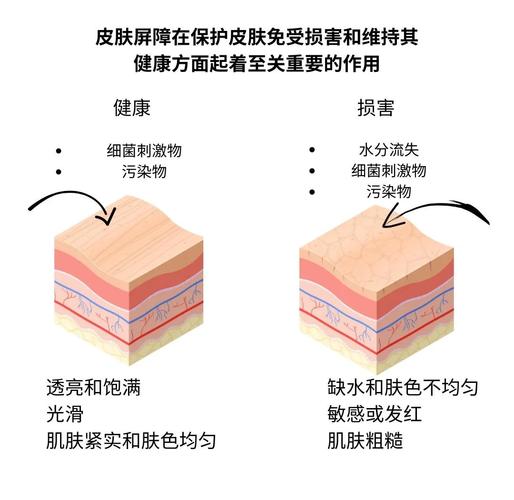 健康皮肤与受损皮肤屏障对比示意图