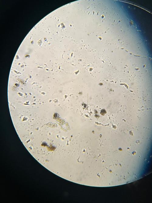 洗菜池内壁附着生物膜显微镜观察图