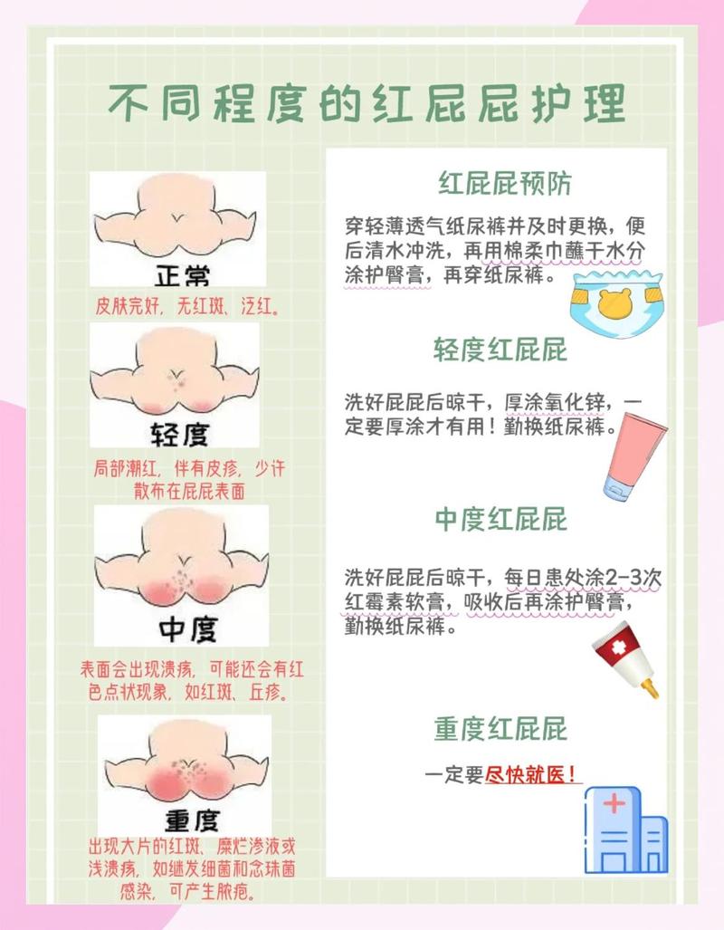 新生儿宝宝臀部护理皮肤结构原理示意图
