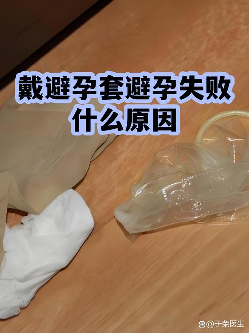 最容易忽略的几个佩戴误区