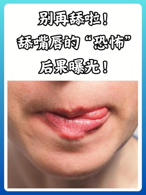 这些毁唇坏习惯,赶紧停手