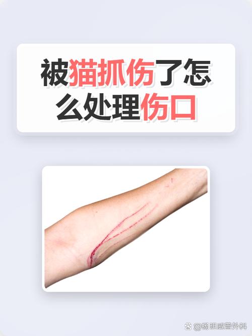 儿童被猫抓伤后伤口冲洗步骤图