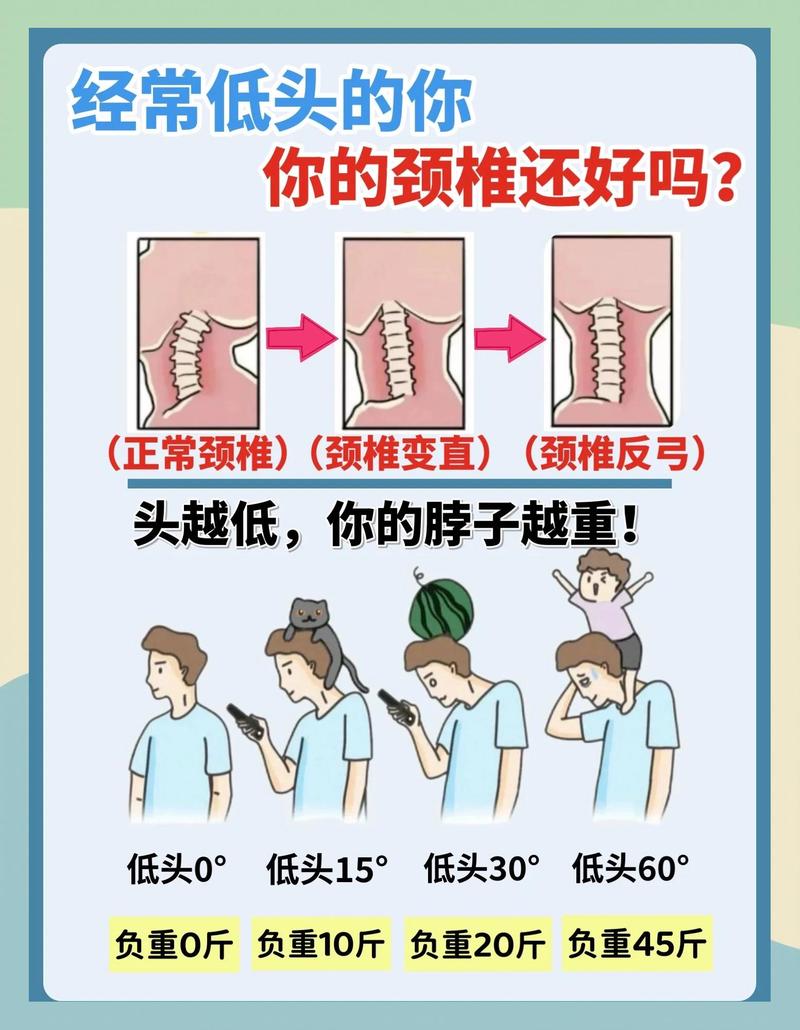 久坐低头族肩颈肌肉紧张示意图