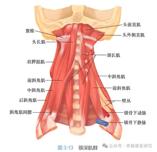 紧张性头痛颈肩肌肉牵连示意图