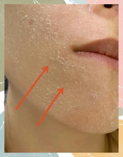 美妆教程粉底液卡粉起皮特写对比图